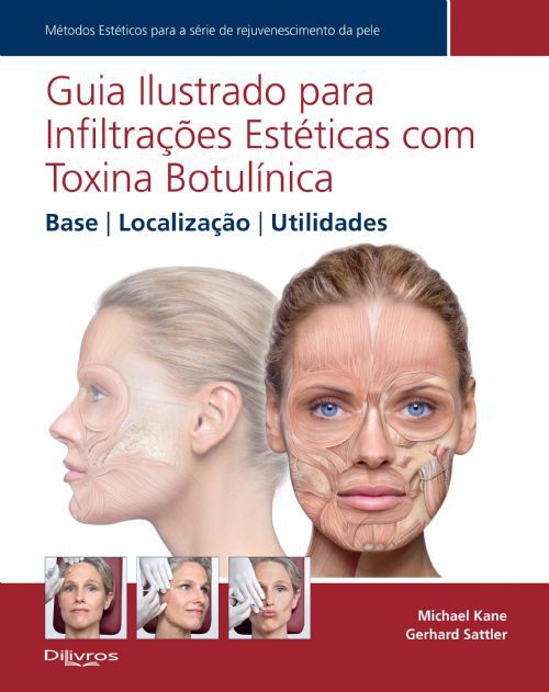 guia-ilustrado-para-infiltraçoes-esteticas-com-toxina-botulinica